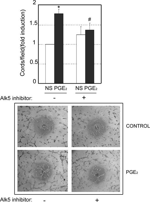 Figure 5. Inhibition of the kinase activity of Alk5 impairs PGE2-induced angiogenesis in vitro. Top panel: HUVECs were pretreated with vehicle or the Alk5 inhibitor SB431542 (5 μM) for 15 minutes and then seeded onto growth factor reduced Matrigel in the presence or absence (NS) of 1 μM PGE2. Formation of cords was quantified after 5 hours. Data are presented as the fold induction (FI) above cord formation by untreated cells, and are the means plus or minus SD of 3 independent experiments. The absolute value corresponding to FI = 1 was 65 cords/field. All experiments were run in triplicate. *P < .001 vs control; #P < .01 vs PGE2 alone. Bottom panel: photographs showing representative fields from experiments quantified in the top panel.