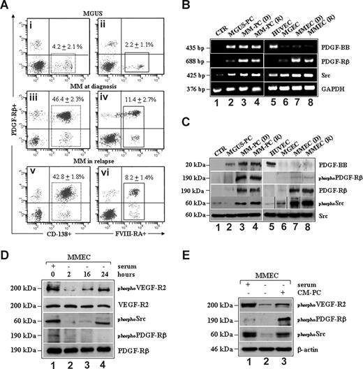 Figure 1. Expression and phosphorylation of PDGFRβ and c-Src TKs in MM patient-derived plasma cells and ECs. (A) FACS analysis of BMMCs from a representative patient with MGUS or active MM at diagnosis and relapse. Numbers on plots are percentages (± SD) of total cells gated. RT-PCR (B) and Western blotting analysis (C) of PDGF-BB, PDGFRβ, and pp60c-Src expression in control BMMCs (CTR), plasma cells isolated from MGUS (MGUS-PC) MM at diagnosis (MM-PC, D), and relapse (MM-PC, R). HUVEC (D) and ECs isolated from a representative patient with MGUS (MGEC), MM at diagnosis (MMEC, D), and MM in relapse (MMEC, R) were also included. All cells were serum-starved for 16 hours before immunoblotting analysis of constitutive phosphorylation of PDGFRβ (phosphoPDGFRβ) and pp60c-Src (phosphoSrc). Vertical lines have been inserted to indicate repositioned gel lanes. (D) Total cell lysates from control (1) and serum-starved MMECs at different time points (1-4) were probed with the indicated antibodies. (E) MMECs cultured in the presence of serum (1) were starved for 2 hours (2) and incubated with the conditioned medium (CM) harvested from MM plasma cells (CM-PC; 3) for 15 minutes. Whole cell lysates were then prepared and analyzed by SDS-PAGE analysis as shown.