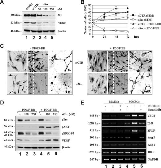 Figure 5. Silencing of c-Src abrogates autocrine VEGF-induced MM patient ECs (MMECs) proliferation in vitro, but not the stimuli elicited by PDGF-BB. (A) MMECs were transfected with 50 to 250 nM (lanes 3-5) of siRNA for c-Src (siSrc), 250 nM of a control siRNA (2), or carrier alone (1). After 48 hours, total lysates were analyzed for c-Src and VEGF expression. (B) Proliferation of MMECs transfected with either 250 nM siCTR or siSrc for 24 hours and cultured with or without 10 ng/mL PDGF-BB for an additional 24 hours. Data are means (± SD) of 3 independent experiments (P < .05). (C) Morphologic features of siRNA-transfected MMECs when tested for the effects of PDGF-BB on cell adhesion to fibronectin-coated plates (left panels), motility (middle panels), and angiogenic activity (right panels). (D) Molecular dissection of VEGF expression and activation of signaling molecules in siRNA-transfected MMECs. (E) RT-PCR analysis of proangiogenic genes in serum-starved MGECs and MMECs and after exposure to recombinant PDGF-BB 10 ng/mL alone or with dasatinib 50 nM for 8 hours.