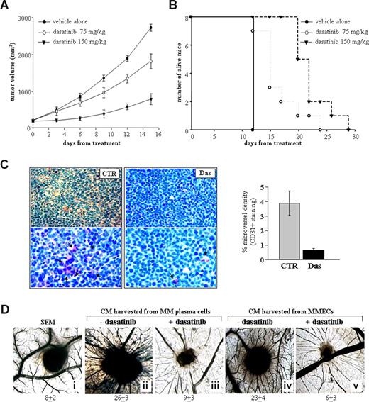 Figure 6. Dasatinib inhibits MM tumor growth and angiogenesis in vivo. (A) Animals were killed when their tumors reached 2 cm in diameter or when paralysis or major compromise in their life occurred. Tumor volume is indicated as mean (± SD). (B) Survival was evaluated from the first day of treatment until death. (C) Representative microscopic images of tumor sections costained with hematoxylin and oesin and anti-CD31. (D) Angiogenic responses induced by gelatin sponges soaked with MM patient plasma cells (ii) or EC (iv) conditioned-medium compared with the sponge treated with medium alone (i). After treatment of the CAM with 50 nM dasatinib (iii and v, respectively), significantly fewer vessels surrounded the sponges (original magnifications ×50). Vessel counts are indicated.