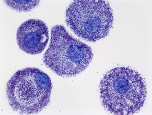 Figure 1. Human mast cells cultured from peripheral blood in SCF and stained with toluidine blue (cytoprep; 400×). The figure is provided courtesy of Madeleine K. Radinger (Laboratory of Allergic Diseases, National Institute of Allergy and Infectious Diseases, National Institutes of Health (LAD/NIAID/NIH). Images were obtained via digital microscopy using a Zeiss Axiophot (Jena, Germany) equipped with a Plan-Apochramat 100×/1.4 numeric aperature (NA) objective. Images were processed using Adobe Photoshop version 3.0 (Adobe Systems, San Jose, CA).