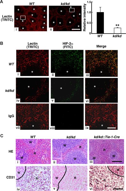 Figure 3. Comparison of HIF-2α and CD31 expressions among WT, kd/kd, and kd/kd::Tie-1-Cre mouse spleens. (A) Left and center panels: Structures of microcapillary in the spleen of WT (i) and kd/kd (ii) were examined by the injection of TRITC-conjugated lection. Note that lection-bound cells form capillary-like structures in red pulps. *Area of white pulps in spleens. Bar represents 500 μm. Right panel: Fluorescent intensity of TRITC was measured in 9 separate fields of view in the red pulp area. The fluorescent frequency measured in a field of WT was normalized to a value of 1 and the average of relative fluorescent intensity was indicated (**P < .01). Error bars represent SD. (B) Left columns (TRITC; i, iv, and vii) represent magnified view of rectangle area shown in panel A. Middle columns (FITC; ii, v, and viii) represent fluorescent immunohistochemistry of HIF-2α in spleen. Right columns (iii, vi, and ix) represent merged pictures to examine HIF-2α-positive microcapillaries (yellow color). Sections from WT (i-iii) and kd/kd (iv-vi) mice are shown. (vii-ix) Normal rabbit IgG was used in WT sections as a negative control. *Area of white pulps. Bar represents 100 μm. (C) Histochemical staining was undertaken in spleens using hematoxylin and eosin (HE) (i-iii) and anti-CD31 antibody (iv-vi). Left panels, middle panels, and right panels represent WT, kd/kd, and kd/kd::Tie-1-Cre mice, respectively. W and R represent white pulp and red pulp, respectively. Bar represents 100 μm.