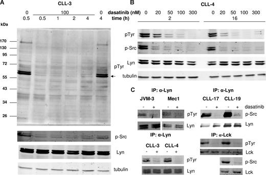 Figure 2. Dose and time dependency and specificity of SFK inhibition by dasatinib in CLL cells. Lysates of CLL cells and of prolymphocytic cell lines were analyzed for general tyrosine phosphorylation (pTyr) or specifically for the positive regulatory phosphotyrosine in SFKs (p-Src). Before phosphorylation analysis, freshly prepared purified CLL cells were cultivated either for various times in the presence of 100 nM dasatinib (A) or for 2 or 16 hours in the presence of different concentrations of dasatinib (B). After 2 hours incubation without (−) and with (+) 100 nM dasatinib, cells were analyzed for the activation of specific SFKs by probing immunoprecipitated Lyn or Lck protein for tyrosine phosphorylation (C).