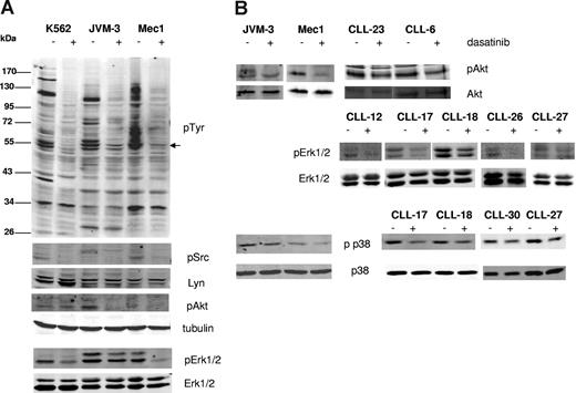 Figure 3. Dasatinib effects on tyrosine phosphorylation and downstream signaling in leukemia cells. The effects of treatment with 100 nM dasatinib for 2 hours were compared in the Bcr-Abl positive cell line K562 and the prolymphocytic cell lines JVM-3 and Mec1 (A). The phosphorylation status of the downstream mediators Akt, Erk1/2 and p38 with and without dasatinib treatment was probed in the cell lines JVM-3 and Mec1 and in freshly isolated CLL cells using phosphospecific antibodies and controlled by detection of the expression levels of the respective proteins (B).