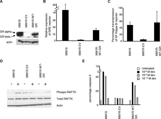 Figure 1. Characterization of MM1R cells expressing wild-type GR. (A) Western blot analysis of MM1S, MM1R-EV, and MM1R with wild-type GR-α (MM1R-WT-GR). Two bands in MM1S cells correspond to GR-α and beta isoforms. (B) GRE reporter expression by dexamethasone treatment (10−6 M for 12 hours) comparing MM1S cells to MM1R cells with empty vector (MM1R-EV) and MM1R-WT-GR. Data shown as fold induction calculated as described in “Reporter assays” and reported as mean plus or minus SD; n = 3. MM1R-WT-GR cells demonstrate significantly increased dexamethasone-induced reporter expression compared with MM1R-EV cells (P < .05). (C) NF-κB transrepression assay, reported as percentage repression of reporter expression on dexamethasone treatment compared with the untreated control (mean ± SD). MM1R-WT-GR cells demonstrate significantly greater NF-κB repression compared with MM1R-EV cells (P < .05). (D) Western blot analysis of MM1R cells for total RAFTK, phospho-RAFTK, and actin with and without dexamethasone treatment (10−6 M) for 14 hours. (E) Percentage of cells undergoing apoptosis. Caspase 3 assay with flow cytometric analysis of cells treated with 3 concentrations of dexamethasone and analyzed at 60-hour time point. Experiment was done twice with similar results.