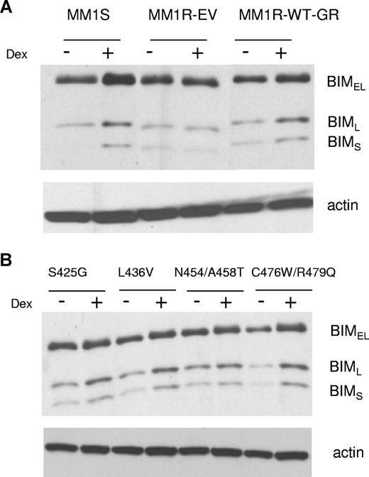 Figure 6. BIM induction in MM1S cells and MM1R cells expressing different GR mutants with dexamethasone treatment (10−6 M for 14 hours). (A) Western blot analysis of BIM induction in MM1S, MM1R-EV, and MM1R with wild-type GR (MM1R-WT-GR). With actin control. (B) MM1R cells with 4 GR mutants and actin control.