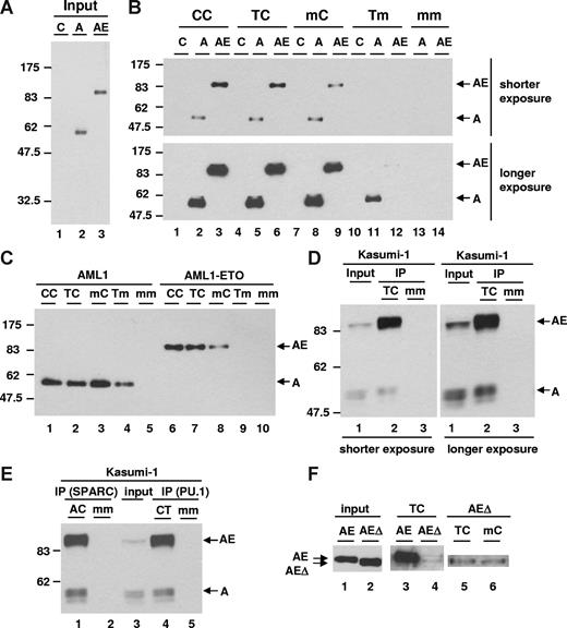 Figure 3. DNA-binding affinity assay. (A) Expression level of AML1 (A) and AML1-ETO (AE) was examined by immunoblotting with anti-HA antibody in nuclear extracts. Control (C) was prepared from 293T cells transfected with vector. (B) DNA-binding affinity assay using wild-type and mutant separase probes with nuclear extracts shown in panel A was performed. The protein binding was detected by immunoblotting with anti-HA antibody. show the position of both AML1 (A) and AML1-ETO (AE). (C) DNA affinity purification assay using wild-type and mutant separase probes with nuclear extracts shown in panel A was performed. AML1 reaction (10 μL) and AML1-ETO reaction (5 μL) were loaded. (D) DNA affinity purification assay with Kasumi-1 cells was performed. Input lane shows the relative expression of endogenous AML1 and AML1-ETO examined by immunoblotting with anti-AML1 antibody in nuclear extracts. The protein-binding activity of wild-type (TC) or mutant (mm) separase probes was examined by immunoblotting with anti-AML1 antibody and shown in IP lanes. (E) DNA affinity purification assay with Kasumi-1 cells using wild-type or mutant SPARC and PU.1 probes was performed. Input lane shows the relative expression of endogenous AML1 and AML1-ETO examined by immunoblotting with anti-AML1 antibody in nuclear extracts. The protein-binding activity of wild-type (AC for SPARC and CT for PU.1) or mutant (mm) probes was examined by immunoblotting with anti-AML1 antibody and shown in IP lanes. (F) Expression level of full-length (AE) and NHR2-deleted (AEΔ) AML1-ETO in nuclear extracts was examined by immunoblotting with anti-HA antibody (input, lanes 1 and 2). The results of DNA affinity purification assay using wild-type (TC) or mutant (mC) separase probes with full-length (lane 3) and NHR2-deleted (lanes 4-6) AML1-ETO are shown. show the position of both full-length (AE) and NHR2-deleted (AEΔ) AML1-ETO.