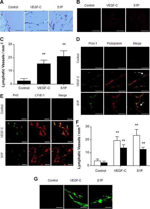 Figure 2. S1P promoted in vivo lymphangiogenesis. Ten days after subcutaneous injection of Matrigel containing none, VEGF-C (1 μg), or S1P (0.4 μg), in C57BL/6 mice (5 mice per group), the Matrigel was removed, fixed, embedded in paraffin, sectioned at 4 μm, and immunostained. (A) Cross-sections of Matrigel were stained by H&E. Scale bars represent 50 μm. (B,C) Lymphatic vessels in Matrigel were immunostained for podoplanin (red). Representative photographs and the number of podoplanin-positive lymphatic vessels per field are shown in panels B and C, respectively. Scale bars represent 200 μm. (D) Lymphatic vessels in Matrigel were immunostained for Prox-1 (green) and podoplanin (red). Arrows show sprouting lymphatic vessels. Scale bars represent 50 μm. (E,F) Proliferating lymphatic endothelial cells in Matrigel were double immunostained for PH3 (green) and LYVE-1 (red). Representative photographs are shown in panel E. Scale bars represent 20 μm. The number of LYVE-1+ (□) or LYVE-1+/PH3+ (■) vessels per field were counted (F). (G) Uptake of injected FITC-dextran (2000 kDa) into newly formed lymphatic vessels was visualized using confocal microscope. Scale bars represent 100 μm. All values are expressed as means (± SEM). ** indicates statistically significant difference (P < .01).