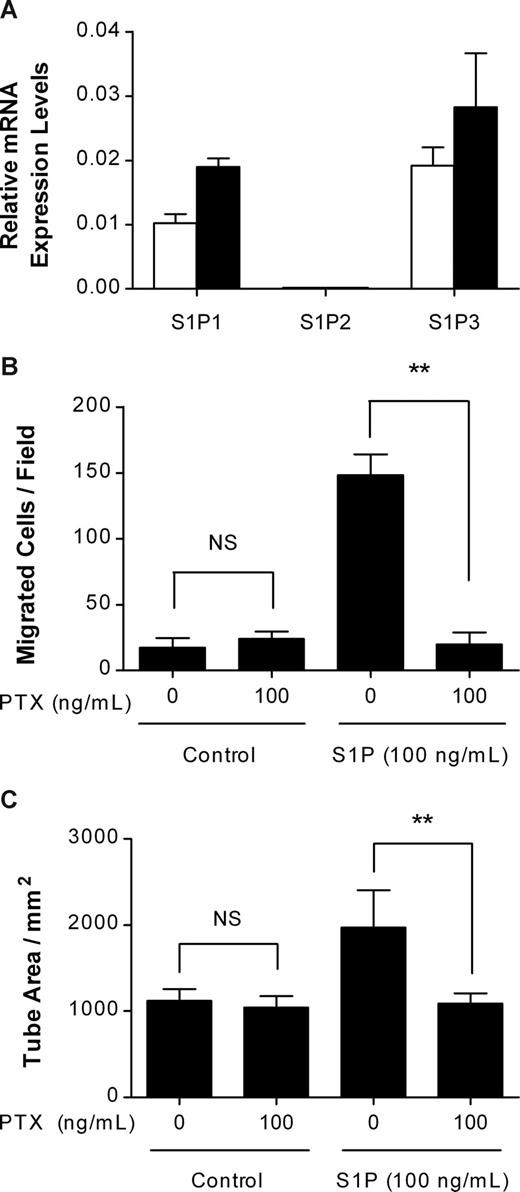 Figure 3. S1P-induced in vitro lymphangiogenesis was mediated through the S1P1/Gi protein. (A) Total RNA (100 ng) from HUVECs (□) or HLECs (■) was amplified using primers for S1P receptors and β-actin. For quantification, the targets were normalized to β-actin as an internal standard. (B) After a 2-hour preincubation with 100 ng/mL PTX, HLECs were treated with 100 ng/mL S1P and 100 ng/mL PTX for an additional 4 hours. The migrated HLECs were stained and counted in 3 random fields. (C) HLECs were laid on a GFR Matrigel-coated 24-well plate and incubated with 100 ng/mL S1P and 100 ng/mL PTX for 6 hours. Two randomly chosen fields per well were photographed and the total tube area was analyzed using Scion Image. All values are expressed as means (± SD). Data are representative of 3 independent experiments with similar results. NS and ** indicate no significant difference and a statistically significant difference (P < .01), respectively.