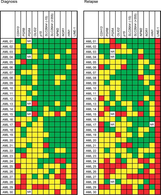 Figure 2. DNA methylation in patients with AML at diagnosis and relapse. Patients are arranged horizontally, genes vertically. Average methylation densities of 0% to 10% are shown in green (0%-15% for PGRB), 10% to 50% methylation in yellow (15%-50% for PGRB); and methylation over 50% in red. NR, no result. We observed increased methylation in AML at diagnosis in 144 of 295 data points and in 175 of 294 data points at relapse.