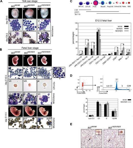 Figure 3. Block in erythroid maturation at the yolk sac and fetal liver stages in sclRER/RER embryos. (A) Yolk sac erythropoiesis. Day E9.5 sclRER/RER yolk sacs (iii) are paler than wild-type and heterozygotes (i,ii). (iv-vi) MGG staining of yolk sac blood shows asynchronous maturation of primitive erythroid cells in mutant homozygous E9.5 embryos. Arrows show immature erythroid cells absent from wild-type and heterozygous control samples (original magnification, ×400). (vii-ix) MGG/benzidine staining of primitive erythroid colonies obtained on plating of day E8.5 sclWt/Wt, sclWt/RER, and sclRER/RER yolk sacs. Arrows point to immature erythroid cells in the mutant homozygous population that are absent from wild-type and heterozygous control samples (original magnification, ×400). (B) Fetal liver erythropoiesis. (i-iii) Day E12.5 embryos. Note the pale sclRER/RER embryo (iii). (iv-vi) MGG-stained E12.5 blood (original magnification, ×400). The inset shows the presence of immature cells in blood derived from sclRER/RER embryos (arrows); (vii-ix) representative CFU-E colonies from wild-type, sclWt/RER, and sclRER/RER E12.5 fetal liver replating (magnification, ×200). Note the poor hemoglobinization of the mutant CFU-E colony (ix); (x-xii) MGG/benzidine staining of CFU-E colonies. Note the lack of mature benzidine positive sclRER/RER erythrocytes (xii) (original magnification, ×400); (xii-xv) day E14.5 embryos. Note the pale sclRER/RER embryo in (xv). (xvi-xviii) Benzidine staining of E14.5 fetal blood (original magnification, × 400). The arrows show the presence of less mature, benzidine-negative erythroid cells in the mutant homozygous sample (xviii) that are absent from the wild-type and heterozygous samples (xvi,xvii). (C) Characterization of fetal liver hematopoietic cells. (Top) Schematic representation of the progressive maturation of erythroid cells and pattern of expression of the cell surface markers c-kit, CD71 and Ter119.37 ProE indicates proerythroblasts; basoE, polyChE, orthoChE, basophilic, polychromatic, and orthochromatic erythroid cells; retic, reticulocytes; RBC, red blood cells. (Bottom) Fetal liver cells derived from wild-type, heterozygous, and homozygous E12.5 embryos were analyzed by fluorescence-activated cell sorting (FACS). The percentages of fetal liver populations characterized by expression of various combinations of cell surface markers are indicated for each genotype. Error bars indicate plus or minus 1 SD from at least 3 independent experiments; *P < .01. (D) Cell-cycle analysis. (Top left) FACS analysis of PI-stained fetal liver cells representative of both wild-type and sclRER/RER E12.5 fetal liver samples. (Top right) The 3 cell cycle phases and the sub-G1 phase are visualized according to PI intensity and pulse width. (Bottom) The graph shows the proportion of fetal liver cells isolated from wild-type and sclRER/RER mice in sub-G1, G1, S, and G2/M phases. Error bars indicate plus or minus 1 SD from at least 3 independent experiments. (E) Apoptosis analysis. Cryosections of wild-type and sclRER/RER E12.5 fetal livers were analyzed by TUNEL assay. Arrowheads point to TUNEL-positive apoptotic cells shown at higher magnification in insets (upper right of both panels; original magnification, ×400).