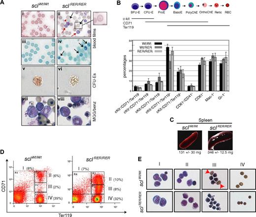 Figure 4. The sclRER/RER adult surviving mice present with mild anemia. (A) (i,ii) Blood films obtained from 2-month-old wild-type and sclRER/RER mice were stained with MGG (original magnification, ×400). Black arrows indicate target cells; red arrows, reticulocytes. (iii,iv) BCB staining confirms the presence of reticulocytes in mutant sclRER/RER blood (arrows) (original magnification, ×400). (v,vi) Representative CFU-E colonies from wild-type and sclRER/RER total bone marrow replating (200× objective). Note the poor hemoglobinization of the mutant CFU-E colony (vi). (vii,viii) MGG/benzidine staining of CFU-E colonies (magnification, ×400). Note the lack of benzidine positive sclRER/RER erythrocytes (viii). (B) Characterization of adult bone marrow hematopoietic cells. (Top) See legend for Figure 3C. (Bottom) Bone marrow cells derived from wild-type, heterozygous, and homozygous 2-month-old mice were analyzed by FACS according to expression of various combinations of cell surface markers. The percentage of total bone marrow cells for each cellular population is indicated. Error bars indicate plus or minus 1 SD from at least 3 independent experiments. (C) Splenomegaly in sclRER/RER mice. (D) Splenocytes harvested from wild-type and sclRER/RER mice were analyzed for expression of the cell surface markers CD71 and Ter119 by FACS. Populations I to IV represent progressive maturation of erythroid cells. Representative FACS plots with the percentage of cells for each population are shown. (E) Cell populations as shown in panel D were sorted and stained with MGG/benzidine. Populations are mainly characterized by I, proerythroblasts; II, basophilic normoblasts; III, late normoblasts; and IV, enucleated red blood cells. Red arrowheads show enucleated cells frequently observed in wild-type population III but not in the corresponding mutant sample. Note the irregular shape of the mutant late normoblasts and the small size of the mutant enucleated cells (sclRER/RER, III and IV, respectively; original magnification, ×400).