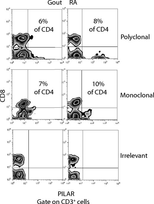Figure 6. PILAR is expressed on T cells in inflammatory synovial fluid. Proportions of PILAR+CD3+CD8− (CD4+) T cells in synovial fluid specimens from rheumatoid arthritis and gout patients using rabbit polyclonal or mouse monoclonal PILAR-specific Abs. Staining with an irrelevant mouse IgG (BD PharMingen, San Diego, CA) is additionally shown.