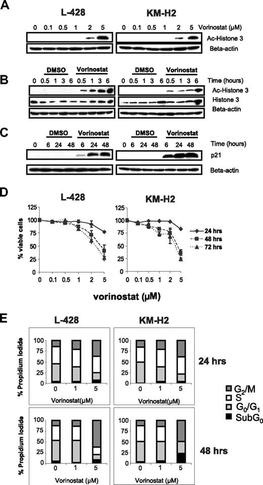 Figure 1. Effect of HDAC inhibitor vorinostat in Hodgkin lymphoma (HL) cell lines. (A) Cells were incubated with 0.1 to 5 μM of vorinostat for 6 hours and whole cell lysates were examined for histone 3 acetylation (Ac-histone 3) using Western blot analysis. During this time frame, histone acetylation was observed using concentrations of 2 μM or higher. (B) Cells were incubated with 5 μM of vorinostat for 0.5 to 6 hours demonstrated that histone acetylation is achieved as early as 0.5 hours of incubation and lasted for at least 6 hours. (C) Vorinostat (5 μM) induced p21 expression as early as 6 hours and lasted for up to 48 hours. (D) Vorinostat induced antiproliferative effects in HL cell lines as determined by the MTS cell proliferation assay. This effect was prominent after 48 hours in culture and was dose dependent. Each value is the mean of 3 independent experiments performed in triplicate (± SEM). (E) The antiproliferative effect of vorinostat was associated with an increase in the G2/M cell-cycle fraction, especially when higher concentrations were used. The G2M fraction was higher after 48 hours of incubation (bottom panel) compared with 24 hours of incubation (top panel). Results are the means of 3 independent experiments.