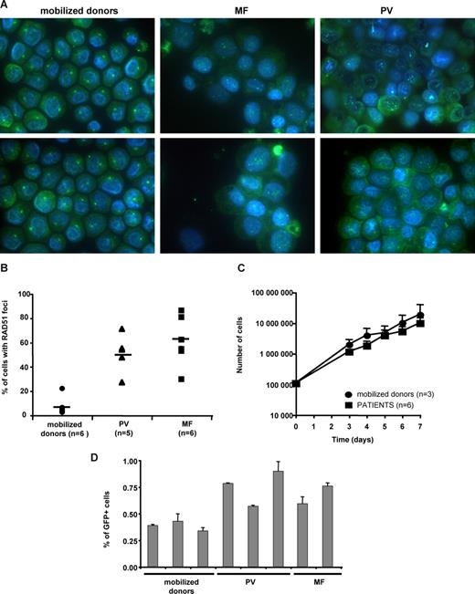 Figure 6. JAK2V617F induces a hyper-recombination phenotype in cells from PV and MF patients. (A,B) Cells were cultured for 5 days in medium containing SCF, IL-3, IL-6, FLT3-L, and TPO. Cells were immunostained with an anti-RAD51 antibody (A), and the percentage of cells with RAD51 foci was calculated (B). At least 60 cells were counted for each patient (PV, n = 5; MF, n = 6) and for mobilized donors (n = 6). Horizontal line represents the mean. (C,D) CD34+ cells were immunopurified either from the blood of either JAK2V617F positive–patients or from the blood of G-CSF–mobilized donors and were cultured in medium containing SCF, IL-3, and EPO. (C) The number of cells was counted during 7 days. (D) At day 5, cells were infected with the retrovirus containing HR substrate (HR-EGFP/3′EGFP), and GFP+ cells were measured 5 days later by cytometric analysis. Error bars represent SE.