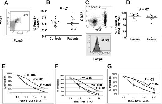 Figure 1. Treg frequency and function in patients with chronic ITP. (A) Representative dot plot of CD25 and Foxp3 reactivity of gated CD4+ T-cell population in PBMCs. Isotype control for anti-Foxp3 antibody was used to set the gates for calculating the percentage of the Foxp3+CD25hi cells within the CD4+ subset. (B) The percentages of Foxp3+CD25hi cells in controls and patients with chronic ITP as calculated by the gating strategy shown in panel A. (C) Representative dot plot of CD4 and CD25 in total PBMCs with the box showing the CD4+CD25hi population. Below the dot plot is the histogram showing the levels of Foxp3 reactivity in the CD4+CD25hi subset expressed as percentage. The gating was set using isotype control for anti-Foxp3 antibody. (D) The levels of Foxp3 reactivity in controls and patients shown as percentages based on gating strategy in panel C. Horizontal bars represent the medians in panels B and D. (E) The mean percentage inhibition of the proliferative response of stimulated CD4+CD25− cells by autologous CD4+CD25hi cells from 13 of the chronic ITP patients (■) and 10 healthy controls (□) was calculated (“Proliferation assay”). CD4+CD25hi and CD4+CD25− sorted cells were stimulated with plate-bound 0.1 μg/mL anti-CD3 antibodies and allogeneic accessory cells, alone or cocultured at various suppressor-responder ratios (1:1, 1:4, and 1:16). Addition of CD4+CD25hi cells at 1:1 ratios to CD4+CD25− cells inhibited proliferative responses and decreasing the number of CD4+CD25hi cells resulted in less inhibition of proliferation. For comparison, percentage inhibition of proliferation of CD4+CD25hi when stimulated alone (1:0) is also shown. Regulatory T cells from patients with chronic ITP showed significantly less suppressor activity. Error bars depict standard error of the mean. (F) CD4+CD25− responder T cells from healthy donors (n = 5) were cocultured with CD4+CD25hi cells from patients with chronic ITP (n = 5) using the same conditions as in panel E, and mean percentage inhibition was calculated for the various responder-suppressor ratios (△). For comparison, the mean percentage inhibition of autologous proliferative responses of patients (n = 13) and controls (n = 10) from panel E is shown. The P values reflect the difference between the suppression of proliferation of CD4+CD25− responder T cells from healthy donors using CD4+CD25hi from healthy controls versus CD4+CD25hi from patients. (G) Responder cells from patients with chronic ITP (n = 3) were cocultured with CD4+CD25hi from healthy controls (n = 3) as in panel E, and mean percentage inhibition was calculated (◇). For comparison, the mean percentage inhibition of autologous proliferative responses from panel E is shown. The P values reflect the difference between the suppression of proliferation of CD4+CD25− responder T cells from patients with chronic ITP using CD4+CD25hi from healthy controls versus autologous patient CD4+CD25hi.