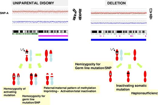 Figure 7. LOH and copy-neutral LOH and their consequences for the pathogenesis of malignant myeloid disorders. SNP-As facilitate detection of LOH. Two types of LOH are depicted using chromosome 7 as an example. SNP karyograms demonstrate monosomy-7 on the right and UPD7q on the left. In the bottom portion, theoretic pathogenetic pathways resulting in LOH due to deletion or UPD are shown. UPD can result in duplication of a somatic activating mutation, acquired homozygosity of a germ line–encoded polymorphism occurring normally in heterozygous form, or duplication of maternal or paternal methylation pattern with either activation or total inactivation of the duplicated allele. In deletion, the remaining allele may harbor a somatic inactivating mutation, leading to hemizygosity of a germ-line polymorphism that carries functional consequences or haploinsufficiency.