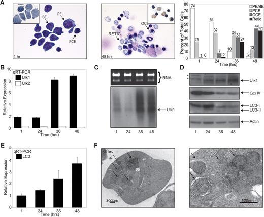 Figure 1. Induction of Ulk1 expression correlates with onset of autophagy and loss of mitochondria during terminal erythroid maturation. Erythroid maturation was examined using the FVA culture system described previously.40 (A) May-Grünwald and benzidine (inset) stains of splenic erythroblasts cultured in the presence of erythropoietin (EPO) for 1 hour (left panel) and 48 hours (center panel). The right panel shows the relative distribution of cells at various stages of erythroid maturation after 1, 24, 36, and 48 hours in culture from a representative experiment. Differentials were performed on more than 300 cells per time point. PE indicates proerythroblast; BE, basophilic erythroblast; PCE, polychromatophilic erythroblast; OCE, orthochromatic erythroblast; and retic, reticulocyte. (B) Quantitative RT-PCR (TaqMan, Applied Biosystems) analysis was performed in triplicate using RNA isolated from cells after 1, 24, 36, and 48 hours in culture. Levels of ulk1 and ulk2 mRNA were normalized to that of 18S RNA. The expression of ulk1 and ulk2 relative to levels in control 3T3 cells is shown in the graph. Error bars represent standard deviation. (C) Northern blot analysis of cells after 1, 24, 36, and 48 hours in culture using an ulk1 cDNA probe (bottom panel). The top panel shows levels of ribosomal RNA on an ethidium bromide–stained agarose gel. (D) Western blot analysis of cells after 1, 24, 36, and 48 hours in culture. (E) Quantitative RT-PCR (TaqMan) analysis was performed in triplicate using RNA isolated from cells after 1, 24, 36, and 48 hours in culture. Levels of lc3 RNA levels were normalized to 18S RNA. The graph shows lc3 RNA levels relative to the 1-hour time point. Error bars represent standard deviation. (F) Representative electron micrographs of autophagosomes containing mitochondria (highlighted by ↗) in a reticulocyte.