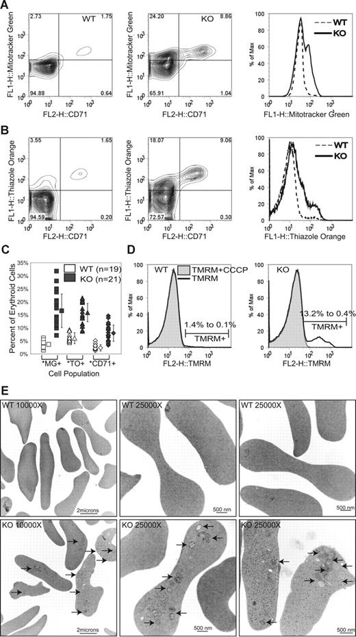 Figure 3. Retention of mitochondria in mature red blood cells of ulk1−/− mice. Peripheral blood from 21 ulk1+/+ (WT) and 19 ulk1−/− (KO) mice ranging in age from 8 weeks to 5 months was analyzed by fluorescence-activated cell sorting (FACS) analysis. (A) Representative contour plot of WT (left panel) and KO (center panel) cells stained with Mitotracker Green FM (y-axis) and CD71-PE (x-axis), with histogram (right panel) showing direct comparison of Mitotracker Green fluorescence (FL1) of the 2 populations (WT vs KO). (B) Representative contour plot of WT (left panel) and KO (center panel) cells stained with thiazole orange (y-axis) and CD71-PE (x-axis), with histogram (right) showing direct comparison of thiazole orange fluorescence (FL1) of the 2 populations. (C) Graph showing percentage of erythroid cells in individual WT and KO animals staining positively with Mitotracker Green FM (MG+), thiazole orange (TO+), and CD71 (CD71+). The population means and standard deviations (error bars) are graphically depicted and show the following statistically significant differences in percentage of Mitotracker Green–positive (3.7% ± 1.2% in WT vs 16.5% ± 6.4% in KO), thiazole orange–positive (7.0% ± 2.1% in WT vs 15.8% ± 4.4% in KO), and CD71+ (3.1% ± 1.2% in WT vs 8.0% ± 3.4% in KO) erythroid cells. Statistically significant differences (P < .001) between WT and KO populations were identified by Student t test analysis and are marked by an asterisk (*). (D) Representative histograms of WT (left panel) and KO (right panel) red blood cells stained with TMRM. The markers denote positive TMRM staining. Each TMRM-stained sample was split into 2 tubes, and the mitochondrial decoupler, CCCP, was added to one of the tubes immediately prior to analysis. The percentage of TMRM-positive cells before (1.4% in WT vs 13.2% in KO) and after (0.1% in WT vs 0.4% in KO) incubation in 50 μM CCCP is shown. (E) Representative electron micrographs of WT (top panel) and KO (bottom panel) red blood cells. ↗ point to intact mitochondria. Ribosomes are seen in a subset of the red cells (bottom right panel).