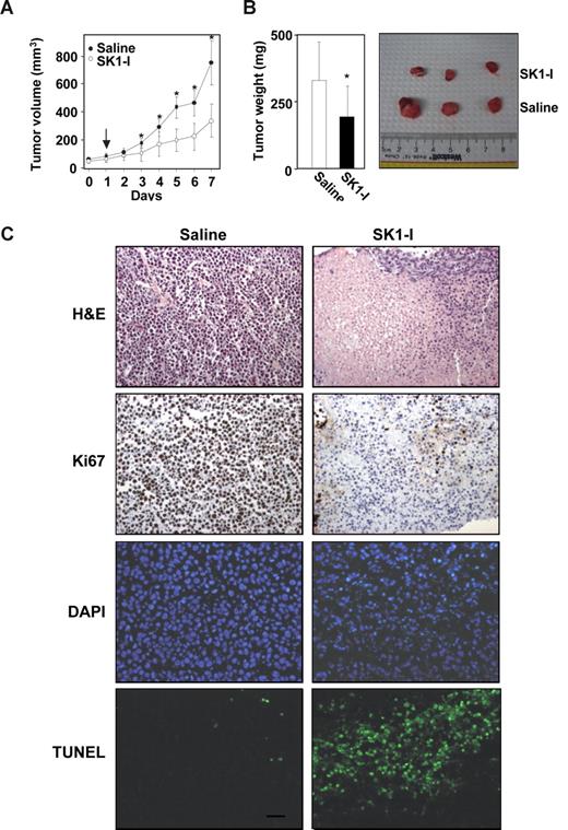 Figure 7. SK1-I suppresses U937 xenograft tumor growth. CB17 SCID/beige mice (5 mice per group) with palpable U937 cell tumors (4 tumors per mouse) were injected intraperitoneally with saline or SK1-I (20 mg/kg) for 7 days. (A) Tumor volumes were measured daily. Data are expressed as mean volumes (± SD). (B) After 7 days, animals were killed and tumors excised and weighed. Average and representative results are shown. *P ≤ .01. (C) Tumor histology. Paraffin-embedded tumor sections were stained with either H&E or immunostained with Ki67. Apoptotic cells were visualized by TUNEL staining and counterstained with DAPI. Slides were examined with an Olympus BX-40 microscope (Olympus, Melville, NY) equipped with a UPlan F1 20×/0.5 NA objective and WH10x eyepiece, and analyzed with RS Image version 1.7.3 (Alpha Innotech). Representative sections from n = 4 individual treated tumors. Scale bar represents 30 μm.