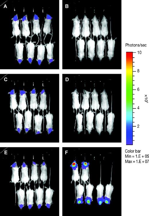 Figure 2. Dasatinib induced regression of well-established intracranial K562-pLUC#2 tumors in vivo. On day 9 after tumor implantation, animals with similarly well-established intracranial tumors were randomized into treatment and control sets (n = 8 mice per set) and baseline images were taken (A,C,E). Mice were then treated orally with either 50 or 25 mg/kg of dasatinib daily for 30 consecutive days. On day 20 after tumor implantation, a second set of bioluminescence images were taken (B,D,F). (A,B) Dasatinib treatment, 50 mg/kg. (C,D) Dasatinib treatment, 25 mg/kg. (E,F) Untreated control. Images were set at the same pseudo-color scale to show relative bioluminescent changes over time and signal intensity differences between treatment groups. Dasatinib treatment resulted in complete regression of intracranial tumors to near nondetectable levels, whereas untreated control showed progressive tumor growth with 2 of 8 animals dead on day 20 after tumor implant.