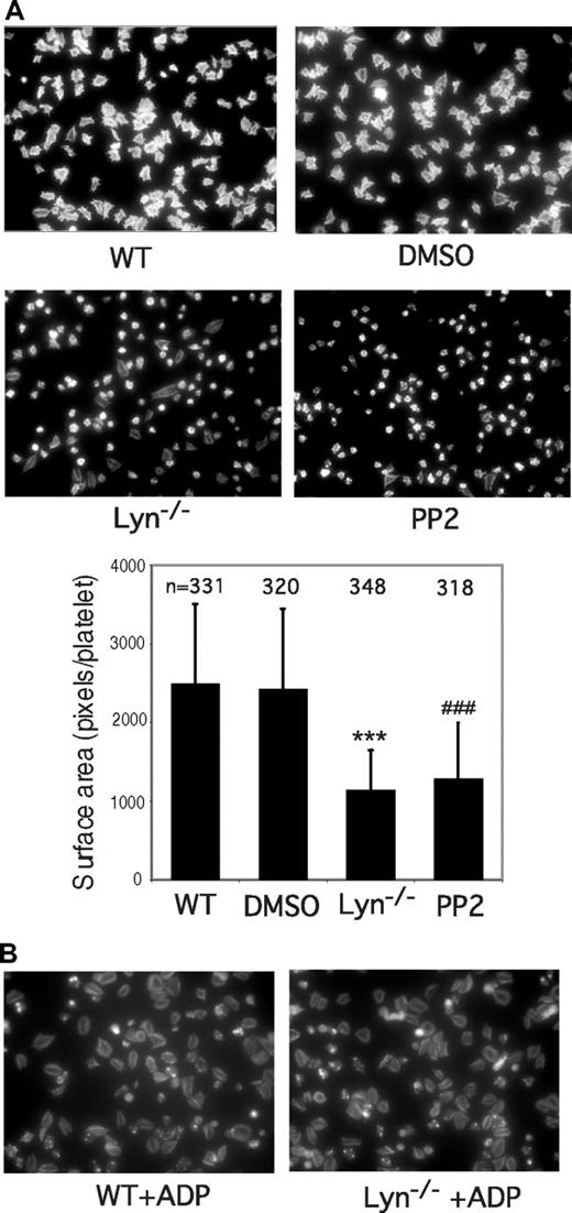 Figure 3. Effects of SFK inhibitor and Lyn knockout on platelet spreading on immobilized VWF. Microtiter chamber slides were coated with 30 μg/mL of VWF. Washed wild-type mouse platelets were preincubated with DMSO or PP2 (10 μM) for 5 minutes. Wild-type or Lyn−/− platelets were allowed to adhere and spread on VWF for 90 minutes in the presence of (A) botrocetin (1 μg/mL) or (B) ADP (10 μM). Adherent platelets were stained with fluorescein-labeled phalloidin and photographed under a fluorescence microscope. Shown are representative pictures from one of 3 experiments with similar results. The bars in the graph represent the average surface area (± SD) of individual platelets. ###P < .001, compared with WT platelets. ***P < .001, compared with DMSO-treated WT platelets. The number of platelets analyzed for each group is indicated above the bars.