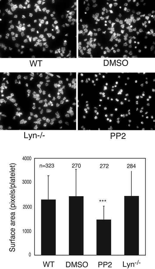 Figure 4. Effect of SFK inhibitor and Lyn knockout on platelet spreading on immobilized fibrinogen. Microtiter chamber slides were coated with 30 μg/mL of fibrinogen. Washed wild-type mouse platelets were preincubated with DMSO or PP2 (10 μM) for 5 minutes. Wild-type or Lyn−/− platelets were allowed to adhere and spread on fibrinogen for 90 minutes. Shown in the figure are representative pictures from one of 3 experiments with similar results. The bars in the graph represent the average surface area (± SD) of individual platelets. ***P < .001, compared with DMSO-treated WT platelets. The number of platelets analyzed for each group is indicated above the bars.