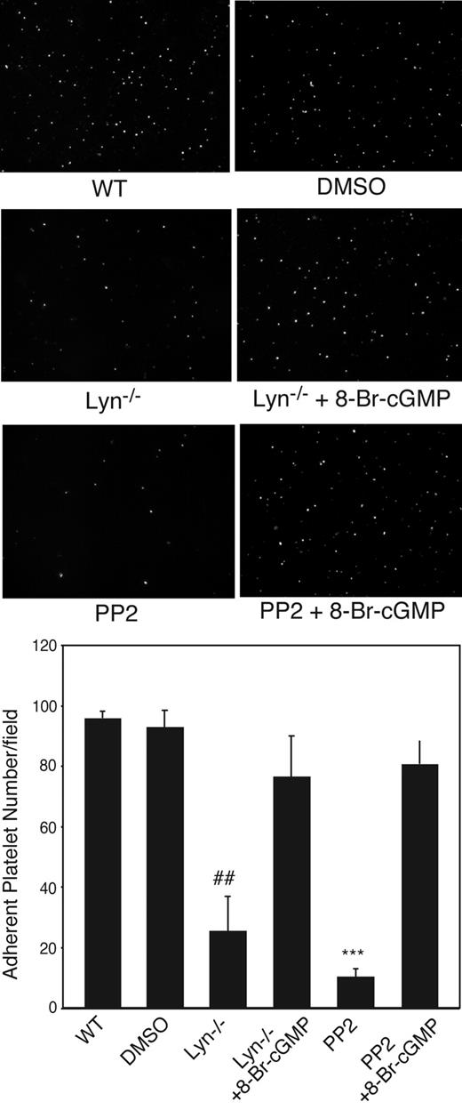 Figure 6. Correction of impaired stable platelet adhesion to VWF in Lyn-deficient or Src inhibitor-treated platelets by exogenous cGMP. Washed mouse platelets were preincubated with DMSO or PP2 (10 μM). Wild-type (WT), Lyn−/−, or PP2-treated platelets were then treated with 10 μM 8-bromo-cGMP and immediately allowed to adhere to VWF under constant shear rate (800 seconds) for 5 minutes. After washing, stably adherent platelets were counted under a fluorescence microscope as described for Figure 2. Shown in the figure are representative pictures and quantitative data (mean ± SD) from 3 different experiments. ##P < .01, compared with WT platelets. ***P < .001, compared with DMSO-treated WT platelets.
