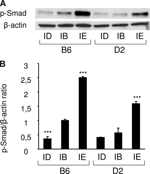 Figure 3. Smad1/5/8 phosphorylation is increased by iron overload and decreased by iron deficiency. (A) Liver lysates from mice fed an iron-deficient (ID), iron-balanced (IB), or iron-enriched (IE) diet (n = 3 in each group) were analyzed by Western blot with an antibody to phosphorylated Smad1/5/8. Blots were stripped and reprobed with an antibody to β-actin as loading control. A representative experiment is shown. (B) Chemiluminescence was quantified using Quantity One software to calculate the ratio of phosphorylated Smad1/5/8 (p-Smad) relative to β-actin. Mean ratios of 3 samples (± SD) are represented on this figure, relative to the mean ratio of the B6 group of mice fed an iron-balanced diet. Statistical significant differences relative to the iron-balanced diet were determined by Student t tests. ***P < .001.