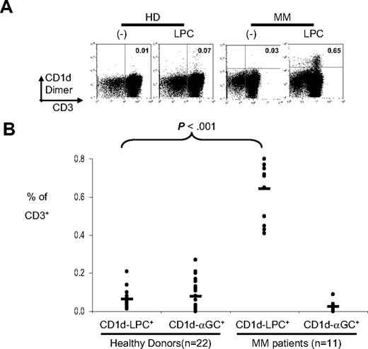 Figure 5. Detection of CD1d-LPC+ T cells in multiple myeloma patients. (A) Representative FACS dot plots of a healthy donor and a myeloma patient stained with CD1d dimer loaded with vehicle control or LPC. The number in the quadrant corresponds with the percentage of cells of total CD3+ cells. Data shown are gated for live cells. (B) Summary of percentage of CD1d-LPC+ cells of total CD3+ for healthy donors (n = 22) and multiple myeloma patients (n = 11). Each dot corresponds to one donor. Horizontal bars represent means (*P < .05).