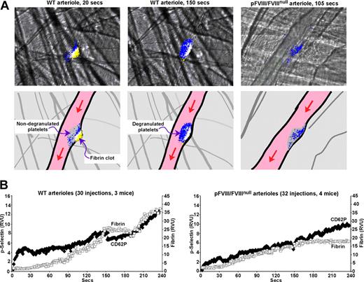 Figure 4. CD62P exposure in WT and pFVIII/FVIIInull mice. Studies as in Figures 1 through 3 with an Alexa647-labeled anti-fibrin antibody, but instead of measuring platelet accumulation using an anti-CD41 Fab fragment, CD62P exposure was measured using an Alexa647-labeled anti-CD62P antibody. (A) Top row shows representative frames from specific points in Videos S1 and S2 of fibrin (yellow) and p-selectin (blue) accumulation with overlap between fibrin and CD62P exposure in white. The left 2 panels present the growth of a clot from a WT arteriole injury shown at an early (20 seconds) and a late (150 seconds) time point after injury. The right panel presents growth of a clot from a pFVIII/FVIIInull arteriole injury at a late (105 seconds) timepoint. The bottom row is a set of cartoons depicting the details of the frames in the top row. Here, the whole platelet plug is shown in gray and the accumulation of fibrin in yellow, with CD62P exposure in blue and overlap in white. The entire Video for the WT injury is available as Video S1 and for the pFVIII/FVIIInull injury, Video S2. (B) Average data analysis for CD62P exposure and fibrin accumulation in WT arterioles (left) and pFVIII/FVIIInull arterioles (right) were carried out as in Figures 1 through 3 except that an Alexa647-labeled anti-CD62P antibody was used. Fibrin is depicted as □ and CD62P as ♦.