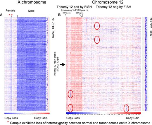 Figure 1. The 50k SNP array platform can detect single copy chromosomal differences in the CLL genome with high sensitivity and specificity. DNA from FACS-sorted CD19+ cells and buccal cells was extracted and prepared for hybridization to the 50kXbaI SNP chips as per manufacturer's recommendation. Copy number estimates for each SNP position were calculated using dChipSNP and displayed for all SNP positions, for all patients, for the indicated chromosomes. Copy losses are displayed with blue colors; copy gains, with red colors. The physical position of SNPs is not linear along the displayed portions of the chromosome. (A) Chromosome X. Color-coded copy number estimates are grouped by the known sex of the patients. Red asterisks indicate females with LOH at chromosome X indicating loss. The estimated copy numbers for all SNP positions for CLL no. 105 are displayed along the entire chromosome to the right of the X chromosome display, with the red line indicating the 2N state. (B) Chromosome 12. All patients with FISH results positive for trisomy 12 are grouped on the left of the image. The estimated copy numbers for all SNP positions for CLL no. 143 is shown along the entire chromosome to the right of the chromosome 12 display, with the red line indicating the 2N state. Sporadic subchromosomal copy losses are encircled with red ovals. The approximate position of the clinically used trisomy 12 FISH probe is indicated.