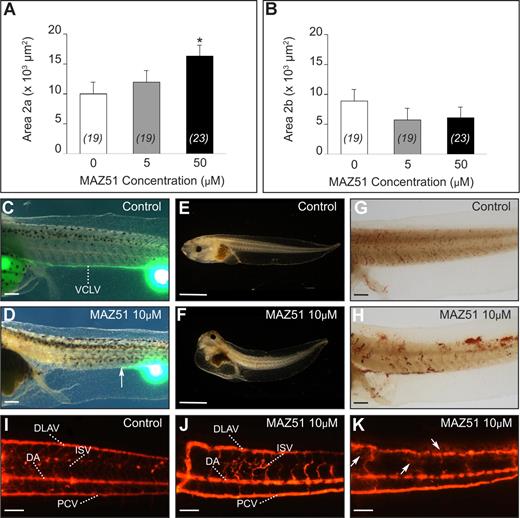Figure 4. Chemical inhibition of xVEGFR-3 signaling with MAZ51 causes lymphatic defects. (A,B) Morphometric measurement of area 2a and 2b in the posterior trunk of xProx1-stained tadpoles at stage 35/36, showing dose-dependent inhibition of migration by MAZ51, reflected by the stalling of the cells in area 2a. *P < .05 versus control (DMSO). The number of tadpoles is indicated within each bar. Error bars represent SEM. (C-K) Functionality of the lymphatic and blood vasculature in control and MAZ51-treated tadpoles. Lymphangiography showed normal filling of the VCLV in DMSO-treated control tadpole (stage 45) (C) without signs of edema (E) and displaying normal intact blood vessels upon microscopic inspection (G) and angiography (I). In contrast, stage-45 tadpoles treated with 10 μM MAZ51 showed dysfunctional lymph vessels upon lymphangiography (D) and edema formation (F). The arrow in panel D indicates the distal site of VCLV filling. Angiography revealed blood vessel defects, including irregularly shaped DLAVs and malformed or absent intersomitic vessels (J,K), and leakage of the fluorescent dye (arrows in K) suggesting vessel fragility. Widespread hemorrhaging throughout tadpoles treated with 10 μM MAZ51 was also suggested by o-dianisidine staining of erythrocytes, showing numerous patches of cells outside of the blood vasculature (H; compare with control in G). DA indicates dorsal aorta; DLAV, dorsal longitudinal anastomosing vessel; ISV, intersomitic vessel; PCV, posterior cardinal vein; and VCLV, ventral caudal lymph vessel. Bars represent 500 μm (C,D,G,H), 1 mm (E,F), and 100 μm (I-K).