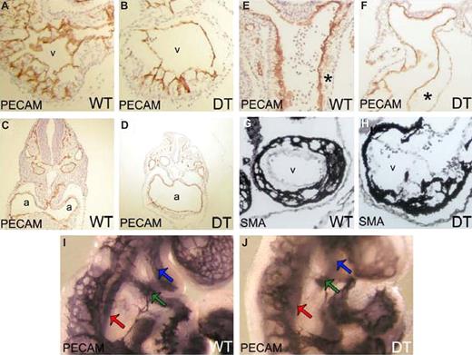 Figure 2. mDll4 overexpression causes morphogenetic defects in the developing heart. PECAM1 immunostaining of cryosections from E9.5 WT and DT embryos (A) WT heart ventricle (v) showing normal trabeculation. (B) DT heart ventricle (v) revealing reduced trabeculation. (C) WT heart atria (a). (D) DT heart atria (a) revealing gross hypertrophy. (E) Outflow tract of heart from WT embryo. (F) Outflow tract of heart from DT embryo, showing acellularization of the outflow tract cushions (*). SMA immunostaining of cryosections from E9.5 WT and DT embryos (G) heart ventricle (v) of WT embryo. (H) Heart ventricle (v) of DT embryo showing aggregation of cardiomyocites at the periphery of the ventricle and irregular distribution of cardiomyocites through the trabeculations, relative to WT. Whole-mount PECAM1 immunostaining of E9.0 WT and DT embryos. (I) WT embryo imaged at the heart level, showing normal arteries at the first (green arrow) and second branchial arches (blue arrow; DA, red arrow). (J) DT embryo imaged at the heart level, showing the presence of a fully formed artery at the first branchial arch (blue arrow) but only a very reduced or nonexistent artery at the second branchial arch (green arrow; DA, red arrow).
