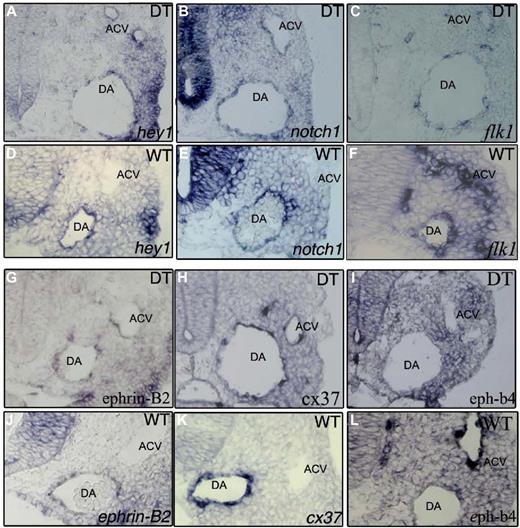 Figure 3. Arterial markers are expressed in all endothelial cells while venous markers are absent in E9.0 DT embryos in situ hybridization. (A,D) hey1 mRNA, (B,E) notch1 mRNA. The Notch markers tested show concomitant expression in the aortae (DA) and ACV of DT embryos. Control embryos (D,E) only show expression of these genes in the endothelium of the aortae. (C,F) flk1 mRNA shows lowered expression in the DT embryos. (G,J) ephrin-b2 mRNA, (H,K) connexin37 mRNA. The arterial endothelial specific markers tested show concomitant expression in the aortae and ACV of DT embryos. Control embryos (J,K) only show expression of these genes in the endothelium of the aortae. (I,L) eph-B4 mRNA is not detectable in the ACV of DT embryos despite being detected in the ACV of control embryos (L).