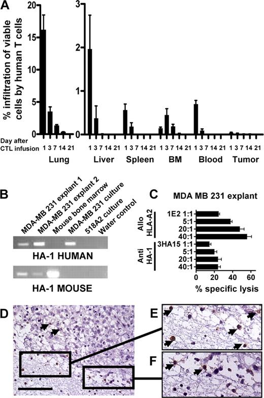 Figure 4. In vivo distribution of HA-1 CTLs and ex vivo analysis of subcutaneous macrotumors. (A) NOD/scid mice with subcutaneous MDA-MB 231 macrotumors were treated with a single dose of 30 × 106 HA-1 CTLs (clone 1.7) intravenously. HA-1 CTLs were quantified by flow cytometry in lung, liver, spleen, bone marrow, peripheral blood, and the solid tumor at 1, 3, 7, 14, or 21 days after CTL transfer. Depicted is the percentage of viable human CTLs in relation to all measured viable cells in the individual tissues. Bars correspond to means plus or minus SEM (4 mice per measurement time point). (B) HA-1 mRNA expression in single-cell suspensions of MDA-MB 231 macrotumors freshly explanted from 2 individual untreated (ie, without HA-1 CTL infusion) NOD/scid mice, mouse bone marrow, and cultured MDA-MB 231 and 518A2 cells determined with human (top row) and mouse (bottom row) HA-1–specific primers. Weak mouse HA-1 mRNA signals in the explanted tumor samples indicate contamination with mouse hematopoietic cells. (C) Single-cell suspensions of MDA-MB 231 macrotumors freshly explanted from 3 individual untreated NOD/scid mice were lysed by allo–HLA-A2 and HA-1 CTLs. X-axis represents percentage of specific lysis (means plus or minus SEM); y-axis, CTL clones in 4 different effector-target ratios. (D-F) Biopsies of MDA-MB 231 subcutaneous macrotumors explanted from untreated NOD/scid mice were embedded in collagen type I matrix and coincubated with the HA-1 CTL clones 1.7, 2.12, and 3HA15 for 3 days. Shown is a representative example of a human CD8 staining. HA-1 CTLs are present only in the surrounding collagen type I matrix and the tumor border. Arrowheads indicate CD8+ CTLs; bar represents 100 μm.