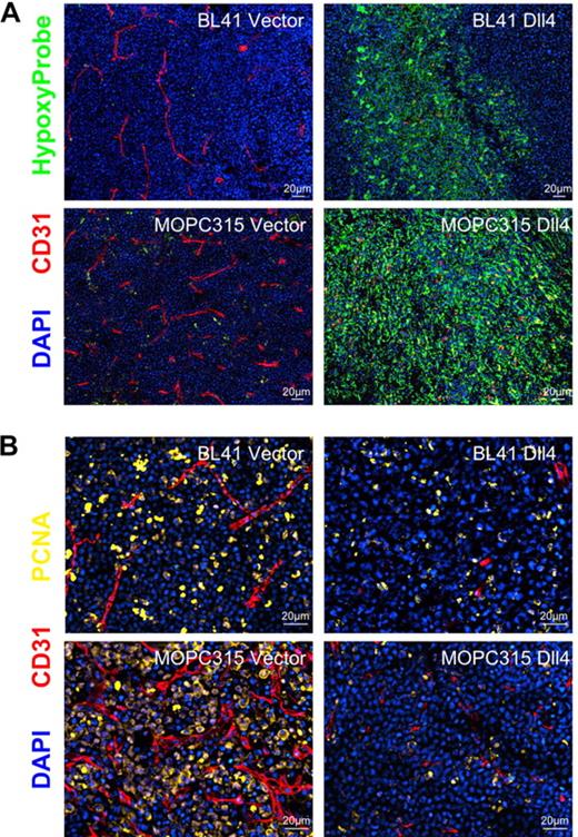 Figure 5. Hypoxia and proliferative rate in Dll4 and control tumors. (A) Control BL41 and MOPC315 tumors display little hypoxia whereas Dll4-BL41 and Dll4-MOPC315 tumors display prominent hypoxia (HypoxyProbe, green). (B) PCNA immunostaining (yellow) shows reduced proliferation rates in Dll4-BL41 and Dll4-MOPC315 tumors compared with BL41 and MOPC315 controls. Tumor vessels (red, CD31 immunostaining) and nuclei (blue, DAPI) are also shown.