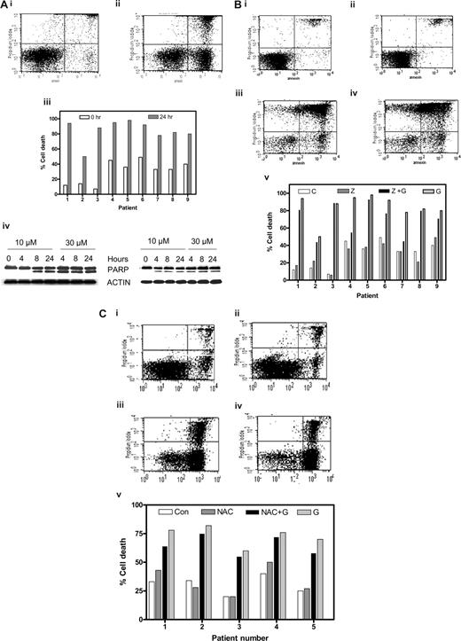 Figure 1. Gossypol-mediated CLL lymphocyte cell death and effect of caspase inhibitor or an antioxidant. (A) Gossypol induces cell death in chronic lymphocytic leukemia (CLL) lymphocytes. CLL primary cells were cultured for 24 hours either (i) alone (control) or (ii) with 30 μM gossypol, and the cell viability was determined by flow cytometry after double staining with FITC-conjugated annexin V and propidium iodide. (iii) Percentage of cell death in CLL primary cells from 9 individual patients treated with gossypol for the indicated times. (iv) CLL primary cells were incubated with 10 and 30 μM gossypol for the indicated times. Cells were lysed and cleavage of PARP was measured by immunoblotting. Actin was used as a loading control. Similar experiments were done in 8 patients, and data from 2 representative patients are shown. (B) Effect of caspase inhibitor on gossypol-induced cell death. CLL primary cells were incubated (i) for 24 hours alone (control), (ii) with Z-VAD.fmk, (iii) with 30 μM gossypol plus Z-VAD.fmk, or (iv) with 30 μM gossypol for 24 hours, and then the cell viability was determined as described in panel A. (v) Percentage of cell death in CLL primary cells from 9 individual patients treated with Z-VAD.fmk and gossypol (C, untreated control; Z, Z-VAD.fmk; Z + G, Z-VAD.fmk plus gossypol; G, gossypol). (C) Effect of antioxidant (NAC) on gossypol (G)–induced cell death. CLL primary cells were incubated (i) for 24 hours alone (control), (ii) with NAC, (iii) with 30 μM gossypol plus NAC, or (iv) with 30 μM gossypol, and then the cell viability was determined as described in panel A. (v) Percentage of cell death in CLL primary cells from 6 individual patients treated with NAC plus gossypol (Con, untreated control).