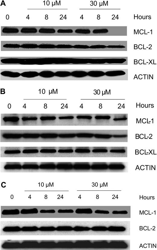 Figure 5. Effect of gossypol on the antiapoptotic proteins of Bcl-2 family members. CLL primary cells were incubated with 10 μM and 30 μM gossypol for the indicated times. Cells were lysed and immunoblotted using antibodies that recognize Mcl-1, Bcl-2, and Bcl-xl. Actin was used as a loading control. Similar experiments were done in 8 patients; data from 3 representative patients are provided (A-C). In panel C the last lane is spliced from the same gel that was originally loaded on lane 8.