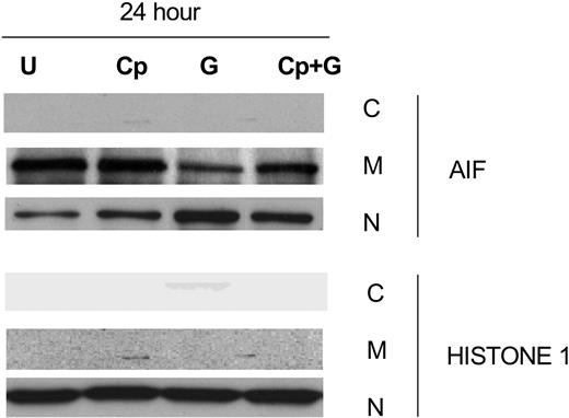 Figure 7. Calpeptin, a calpain inhibitor, partially inhibits AIF release in gossypol-treated CLL primary cells. CLL primary cells were either untreated (U) or treated with 30 μM gossypol (G) in the presence and absence of calpeptin (Cp) for 24 hours, and the expression of AIF was evaluated by immunoblotting in the cytosolic (C), mitochondrial (M), and nuclear (N) fractions. Histone 1 (H1) was used as loading control.