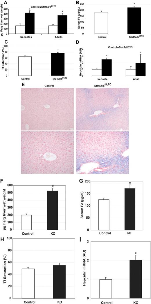 Figure 2. Iron overload in the absence of STAT5A/B. Iron content and hepcidin expression in control and Stat5a/bf/f; TC mice (A-E) and in mice that received a transplant of control or Stat5a/b−/− fetal liver cells (F-I). (A) Non–heme liver iron in adult and neonate female control and Stat5a/bf/f; TC mice. n = 5 neonates; n = 6 adults. (B,C) Serum iron (B) and transferrin saturation (C) in adult female control and Stat5a/bf/f; TC mice. n = 12 in each group. (D) Hepcidin mRNA expression in neonate and adult control and Stat5a/bf/f; TC mice (males and females). Hepcidin expression in control neonate and adult mice is set to 1. n = 9 in each group. (E) Perls Prussian blue iron staining of liver paraffin sections from adult female control and Stat5a/bf/f; TC mice. Original magnification, ×100 in top panel and ×200 in bottom panel. Non–heme iron is stained blue. (F) Non–heme liver iron. (G) Serum iron. (H) Serum transferrin saturation. (I) Hepcidin mRNA expression. Hepcidin expression in mice that received a transplant of control cells is set to 1. n = 5 in each group for all the measurements. *P < .05 compared with control samples. P values were determined by 2-tailed unpaired t test. Error bars represent SEM.