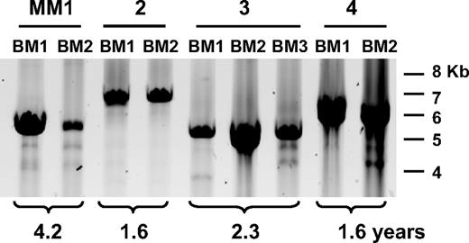 Figure 2. CS-PCR in MM patient time point samples. A representative CS-PCR-A in patients MM1 to MM4 is shown above the panel. BM indicates bone marrow; BL, blood. Time point number is given for each sample, and the time between samples is indicated below the panel. Molecular weight markers are shown on the right. Faint secondary bands below the strong CS-PCR band arise from nonspecific priming by the downstream Sγ1 primer.