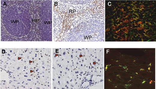 Figure 2. Identification of macrophages as main target for VWF in spleen and liver. (A,B) Spleen sections of VWF-deficient mice treated with recombinant VWF (10 μg/mouse). Spleen was collected 30 minutes after injection. Sections are stained using polyclonal anti-VWF antibodies (A) or the anti–mouse macrophage marker F4/80 (B), and counterstained using hematoxylin (magnification 200×). RP indicates red pulp; WP, white pulp. (C) Merged image of a spleen tissue section stained with anti–mouse F4/80 antibody (red) and polyclonal antihuman antibodies VWF (green). Original magnification 400×. (D,E) Liver sections of VWF-deficient mice treated with recombinant VWF (10 μg/mouse). Liver was collected 30 minutes after injection. Sections are stained using polyclonal anti-VWF antibodies (D) or a monoclonal anti–mouse CD68 antibody (E), and counterstained using hematoxylin (magnification 200×). (F) Merged image of liver tissue section stained with anti–mouse CD68 antibody (red) and polyclonal anti–human VWF antibodies (green). Original magnification 400×. Red arrowheads in panels D and E point to examples of positively stained cells (brown color).