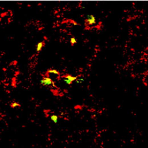 Figure 7. Colocalization of FVIII and VWF in macrophages. Merged image of a spleen tissue section of a VWF-deficient mouse infused with VWF/FVIII complex (10 and 0.25 μg/mouse, respectively) stained with anti–human VWF antibodies (red) and monoclonal anti–human FVIII antibody LE2E9 (green).