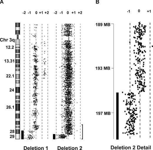 Figure 1. Array CGH of 2 DBA patients with 3q deletions. (A) CGH performed on genomic DNA of EBV lines derived from 2 patients with DBA and chromosome 3q terminal deletions demonstrates single copy terminal deletions of chromosome 3q. The region (bracket) encompassing the smaller deletion (195.46Mb-qter) is enlarged in panel B. Bars to the left of data plots represent segments of copy number loss.
