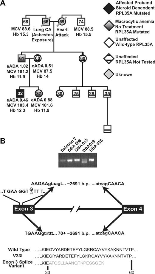 Figure 3. Genotype/phenotype analysis in patient DBA019. (A) RPL35A mutational analysis in this family showed 2 first-degree relatives, a father and sister, with the heterozygous RPL35A 97 G>A mutation. Both of these patients had macrocytic anemia suggestive of subclinical DBA carriers. Hemoglobin (Hb), mean red cell volume (MCV), and eADA activity are indicated; the hemoglobin value indicated for the proband is during treatment with steroids. Erythrocyte ADA was normal in all tested members of this pedigree. Black shading represents the DBA proband; white shading, hematologically unaffected members of the paternal lineage with normal RPL35A sequence; diagonal lines, deceased members with unknown RPL35A status; cross-hatched symbols, clinically normal persons who were not tested for RPL35A mutations. (B) 2 RPL35A RNA products were amplified from patient DBA019 using RT-PCR with primers designed to amplify the full-length RPL35A message. The shorter product results from an alternative splicing event between exons 3 and 4, leading to a truncated protein. The arrows above the transcript diagram show the normal splicing event, leading to wild-type RPL35A and removal of the approximately 2691 nucleotide intron. The lines above exon 3 indicate the wild-type codon sequence within exon 3; the 97 G/A mutation is indicated in gray. The arrows below the line demonstrate the abnormal splicing event. The 97 G>A mutation results in selection of a cryptic splice donor site within exon 3 immediately upstream of the change, causing removal of 70 base pairs of 3′ exon 3 coding sequence in addition to the intron. The predicted amino acid sequence of wild-type, simple amino-acid substitution, and the splicing variant are shown below.