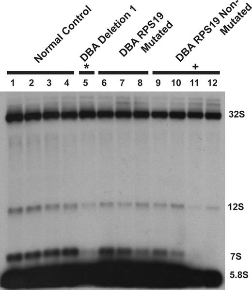 Figure 7. DBA EBV cell lines display altered large subunit pre-rRNA processing. RNA isolated from DBA EBV cell lines was probed with a 5.8S rRNA probe: lanes 1 to 4, healthy subject LCL; lane 5, deletion 1; lanes 6 to 8, DBA LCL with S19 mutations; lanes 9 to 12, non-S19-mutated DBA LCL. An altered 32S:12S ratio was observed in deletion 1 (*lane 5) and DBA019 EBV (+lane 11) cell lines. The sample in lane 12 also has increased 32S:12S with normal RPL35A transcript levels by qPCR and normal sequence for RPL35A and RPS19, suggesting additional gene defects may impair this pre-rRNA processing pathway in DBA.