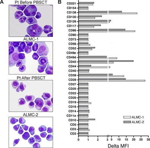 Figure 2. Characterization of ALMC-1 and ALMC-2 cell line morphology and immunophenotype. (A) Wright-Giemsa staining shows the typical plasmacytic features of the primary patient cells as well as both cell lines (original magnification ×60, Olympic Provus AX70 microscope). (B) A panel of antibodies was used to phenotype both cell lines by flow cytometry. Data reflect the ΔMFI as calculated by MFI of specific antibody/MFI of isotype matched control antibody.