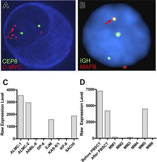 Figure 3. ALMC-1 and ALMC-2 cells exhibit c-myc amplification and a 14;20 translocation. (A) Representative cIg-FISH image of ALMC-1 cells showing c-MYC amplification. (B) Representative interphase FISH image of ALMC-2 cells demonstrating a 14;20 translocation. The fusion signal (arrow) resulting from comigration of the IGH and MAFB probes is consistent with a t(14;20). Original magnification ×100 (Leica DMRXA microscope, Wetzlar, Germany) for panels A and B. (C) MAFB expression levels in ALMC-1 and ALMC-2 cell lines relative to other MM cell lines that do or do not express a t(14;20). (D) MAFB expression levels in primary patient tumor cells relative to a number of other primary patient MM cells.