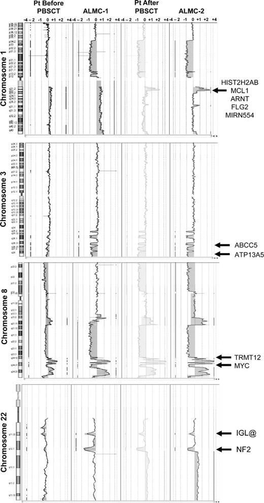 Figure 5. Shared and emerging chromosome copy number abnormalities. Whole chromosome plots of chromosomes 1, 3, 8, and 22 are shown for the 4 samples. Arrows point out examples of gains or losses that appear uniformly across all 4 samples (chromosomes 3, 8, and 22), or are acquired during the course of disease progression (chromosome 1). The predicted number of gene copies is indicated on the top of each panel.